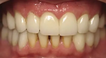 A photo of smile after