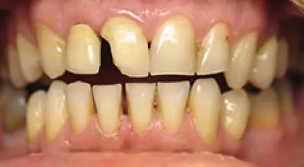 A close up photo before 