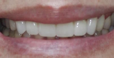 A photo of smile after