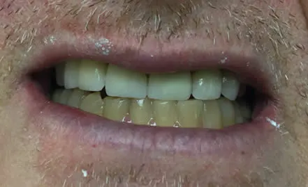 A photo of smile after