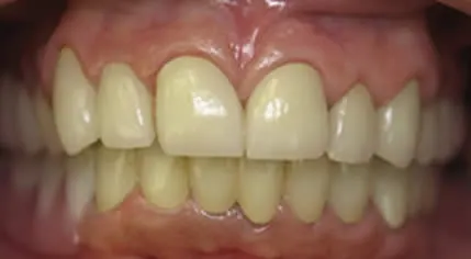 A photo of smile after
