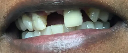 A close up photo before 